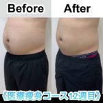 【痩身】オルタ天神クリニックの医療ダイエット