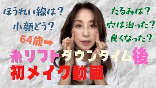 【ダウンタイム後初メイク動画】糸リフトから1ヶ月後のメイク動画です♡傷をかくします！