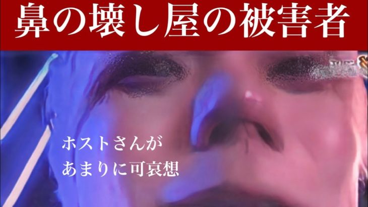 【鼻の壊し屋】とあるビューティクリニックで鼻整形を行ったホストの鼻がぐちゃぐちゃにされた事件〜鼻中隔延長術