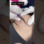 これで美眉が完成します　#アートメイク #湘南agaクリニック