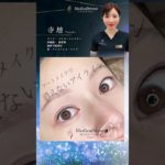 【アイラインアートメイク症例 】 寺地 ナースの症例紹介 #眉メイク#アートメイク#shorts#アイライン #メディカルブロー
