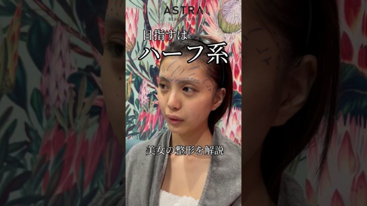 ハーフ系になりたい美女の施術💖#アストラビューティクリニック #astrabeautyclinic #忘れ鼻 #美容整形 #鼻整形 #脂肪注入