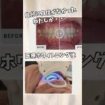 医療ホワイトニングの効果　 #歯医者 #ビューティ #ビューティー