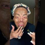 You CAN improve your skin! 🖤 #skincare #beauty #burnsurvivor