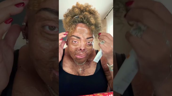 MY DEFINITION OF PERFECT🦋 #skincare #beauty #burnsurvivor #domesticviolencesurvivor