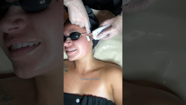 This Facial SAVED My Skin?! 😱 #skincare #beauty #facial