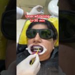 ‼️OFFER⁉️laser whitening @ 5999/- till January 2025 #beauty #transition #makeover #digital #makeup