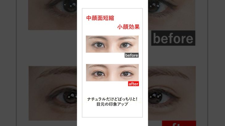 ヒアルロン酸いらず！ナチュラル涙袋メイク