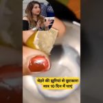 Malai and nimbu benefits remove wrinkles remedy #skincare #glowingskin #beauty #shorts @priyanka3966