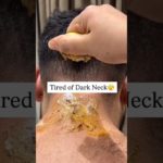 Neck Cleaning Tips ✅ | Dark Neck Home Remedies/Tanning Removal Tips #beauty #skincare #shorts #viral