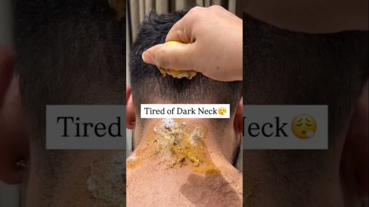 Neck Cleaning Tips ✅ | Dark Neck Home Remedies/Tanning Removal Tips #beauty #skincare #shorts #viral