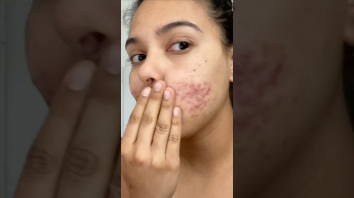 STOP 🛑✋🏽& never do this beauty hack yourself…