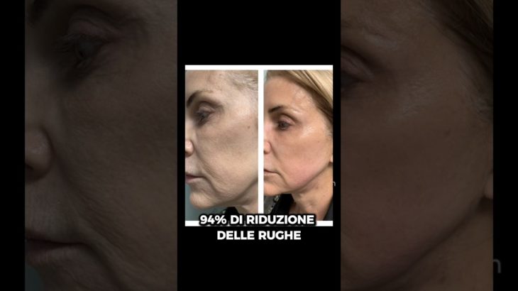 Il Segreto Di BELLEZZA Delle CELEBRITÀ #bellezza #beauty #antiage #skincare #shorts