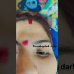 #Removing dark circle#sharmila’s beauty parlour#Raipur# Radhe Radhe