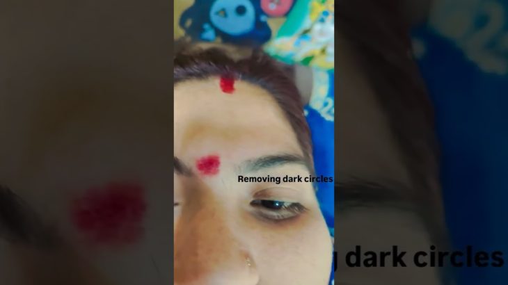 #Removing dark circle#sharmila’s beauty parlour#Raipur# Radhe Radhe