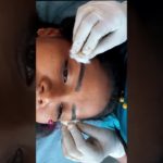 Eyebrow Microblading Magic in Hyderabad | LexusCare Brows & Beauty