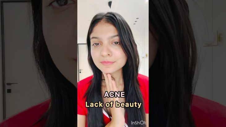 Societal beauty standards!!!