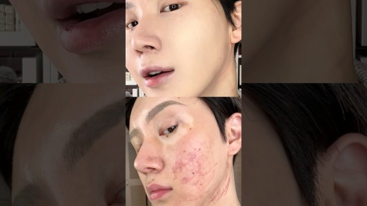 【保存版】ひどい青アザを速攻カバーする鉄壁ベースメイクが凄すぎた…!!