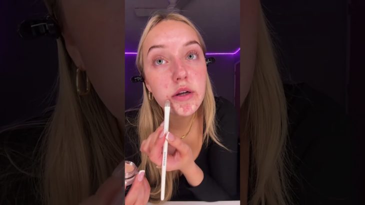 Perfect Acne Coverage Tips #makeup #beauty #acne