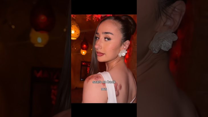 the beauty of your insecurities pt.17✨🛐. #shorts #glowup