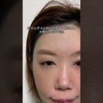 決意　#カバーメイク#太田母斑 #レーザー治療 #あざ治療