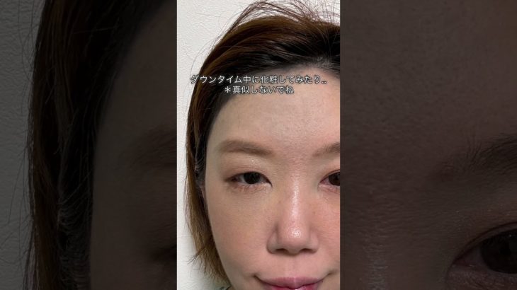 決意　#カバーメイク#太田母斑 #レーザー治療 #あざ治療