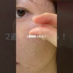 2025年最強の美容液🔥#pr#プレミアムビューティセラムaz #シシベラ美容液 #美容液