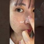 2週間本気でケアした結果#PR#プレミアムビューティセラムAZ#シシベラ美容液 #美容液