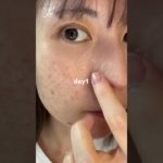 2週間本気でケアした結果#PR#プレミアムビューティセラムAZ#シシベラ美容液 #美容液