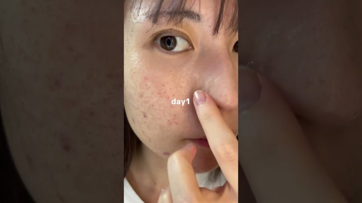 2週間本気でケアした結果#PR#プレミアムビューティセラムAZ#シシベラ美容液 #美容液