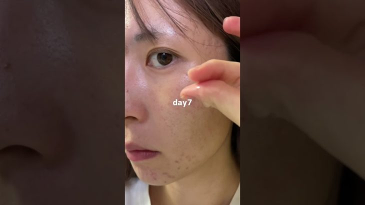 2週間美容液本気出してみた#PR#プレミアムビューティセラムAZ#シシベラ美容液 #スキンケア#美容液