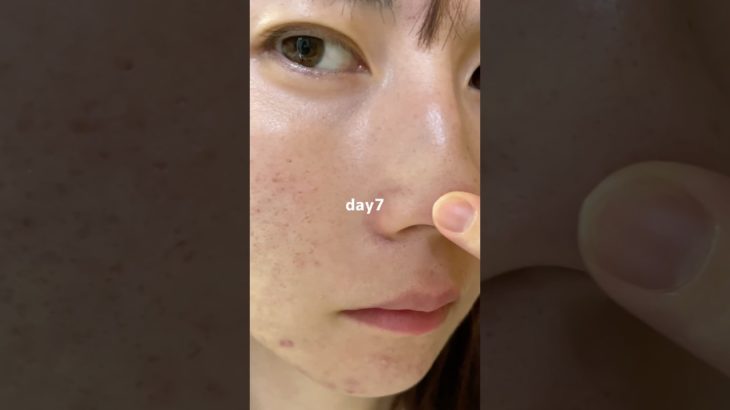 美容液2週間本気出してみた#PR#プレミアムビューティセラムaz #シシベラ美容液 #スキンケア