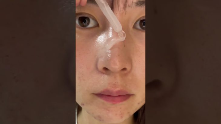 汚い肌を本気でケアしてみた#PR#プレミアムビューティセラムAZ#シシベラ美容液 #スキンケア