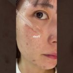 今年最後の美容液チャレンジ#PR#プレミアムビューティセラムaz #シシベラ美容液#肌悩み