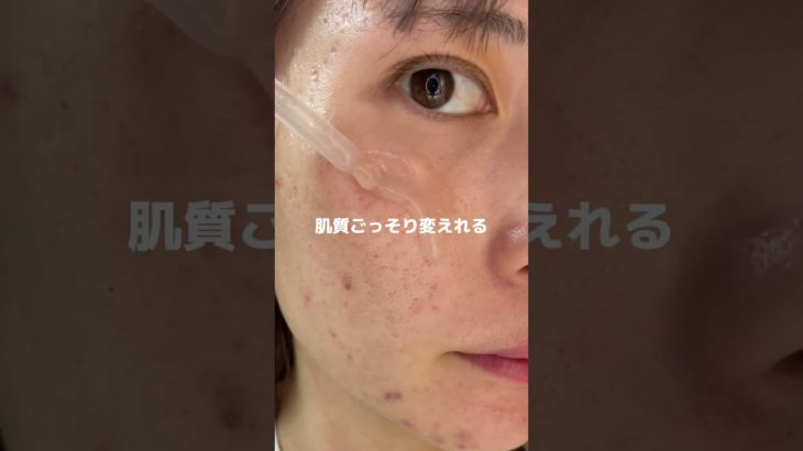 肌荒れしてるならこれ使え#pr#プレミアムビューティセラムAZ#シシベラ美容液#美容液