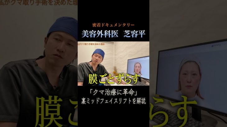 【密着】毎朝のメイク時間を短くしたいという40代女性が来院！クマ取り手術”裏ミッドフェイスリフト”を受ける1日に密着②　#クマ取り #クマ治療 #リフトアップ  #美容整形  #shorts