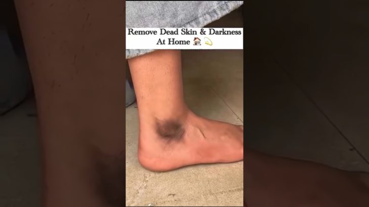 Instant feet darkness Removal. #skincare #viral #shorts #youtubeshorts #beauty #viralshorts #fyp