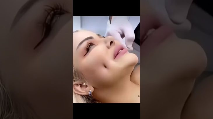 New beauty hack for beautiful dimple #hack #shorts #beauty #makeuptutorial #dimple #explorepage