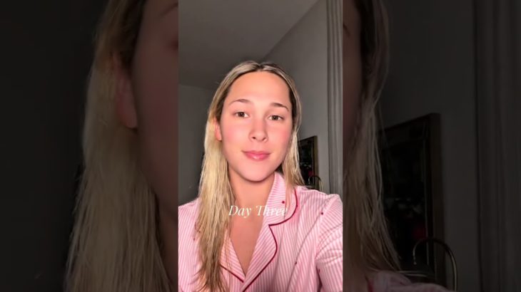 REAL Microneedling Results 🫧🧖🏼‍♀️ #bridal #tips #beauty #wedding #microneedling