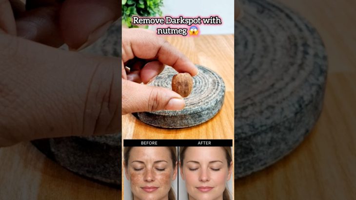 pigmentation treatment on skin home remedy by dr upasana#skincare#beauty#ytshort#shorts