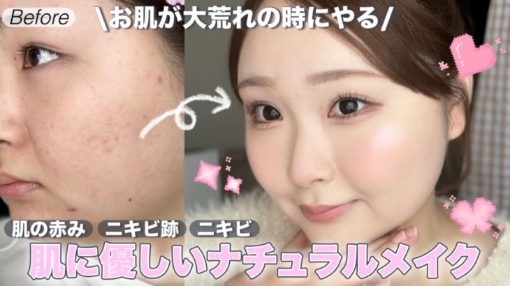 【ニキビ】肌に負担をかけないナチュラルメイク👶🏻🌿垢抜け｜肌荒れ