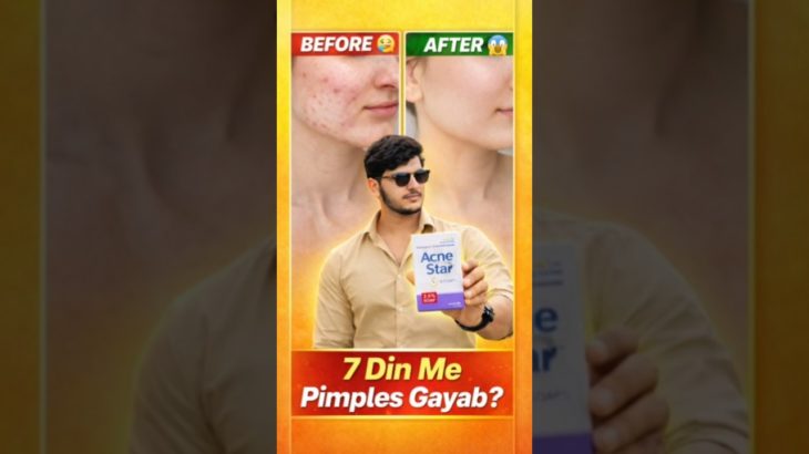 Acnestar Soap se pimple kaise hataye 😱#skincare #beauty #shorts