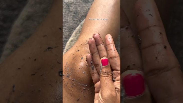 Dark Knees Cleaning Tips | Remove Dead Skin| #beauty#suntan#deadskinremover#viral#shorts