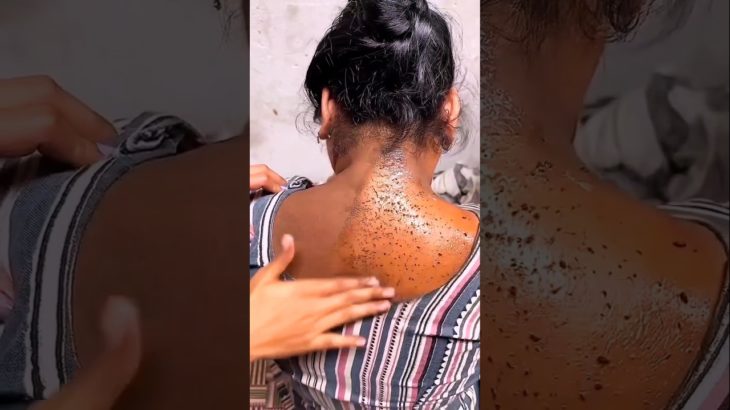 💯 Dark Neck Cleaning Tips | Remove Dead Skin & Suntan #darkneck#beauty#skincare#dark#shorts#glowup#f