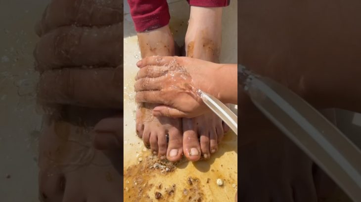 Feet whitening Instantly, 1 Day Fair Feet #feetwhitening #beauty #shorts