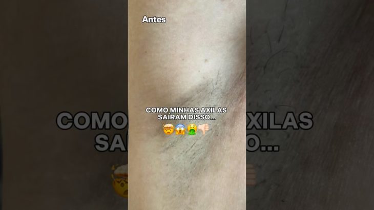 🚨#shorts #shortvideo #short #fyp #foryou #beleza #beauty #dicas #autocuidado