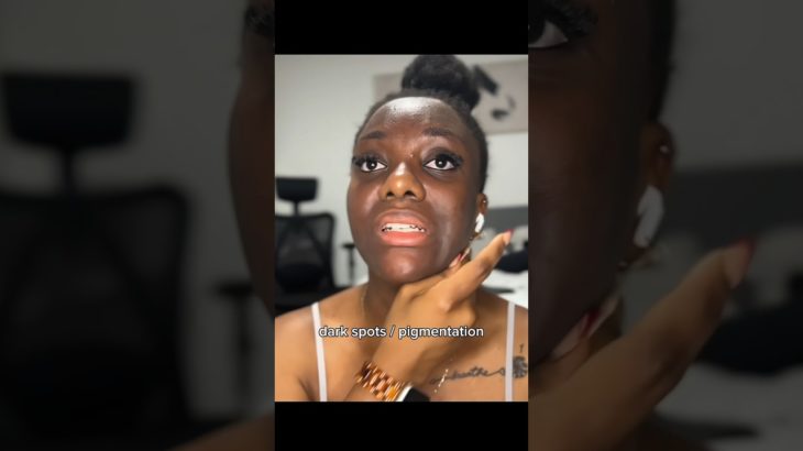 the beauty of your insecurities pt.30✨🛐. #shorts #glowup