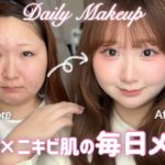 【丸顔×ニキビ】激盛れする❣️春の最新版毎日メイク💖多幸感メイク｜イエベ春