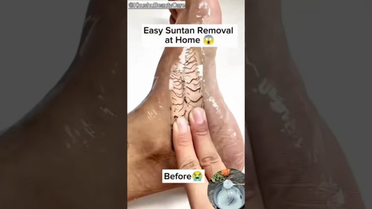 Easy Suntanning Removal Pack At Home, Remove Dirt & Tanning #shorts #beauty #beautytips #tan