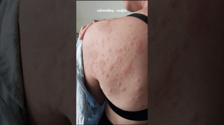 தினமும் ஐந்து அழகு குறிப்புகள் #dailytips #beauty #beautytips #tips #tricks #simpletips #healthtips